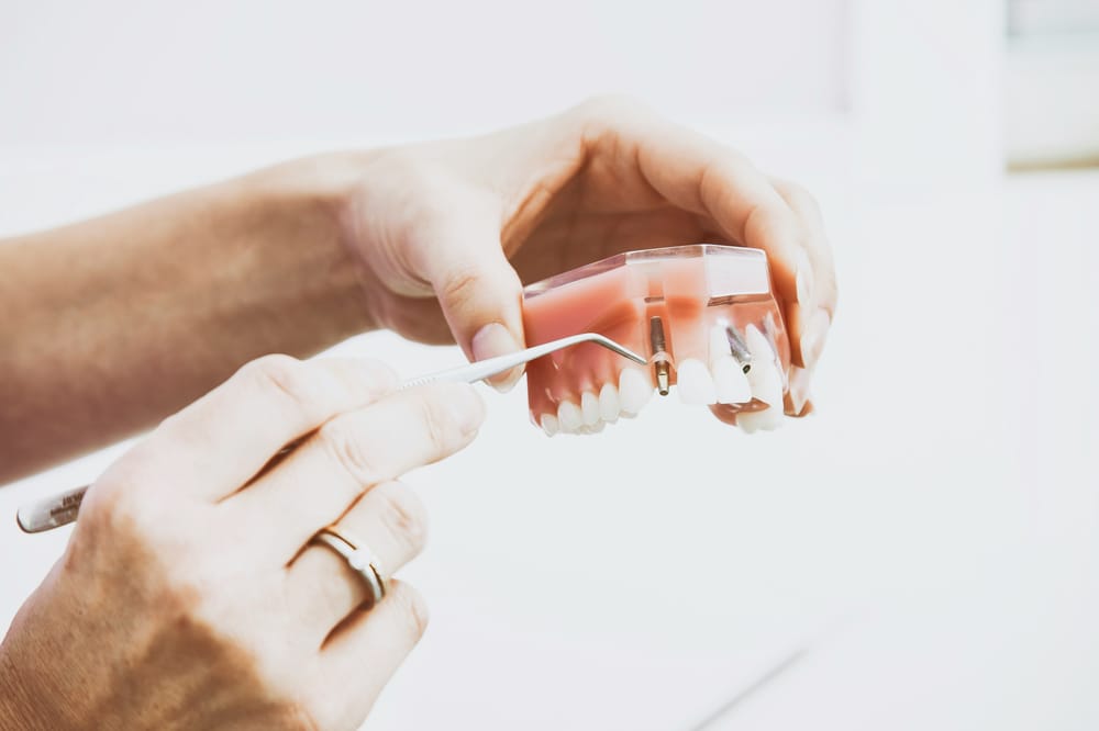 Reparação de Prótese Dentária