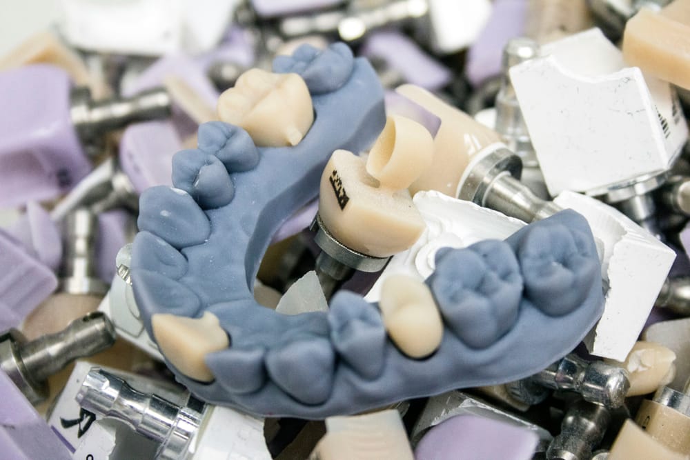 Impressão 3D de Moldes e Peças Dentárias