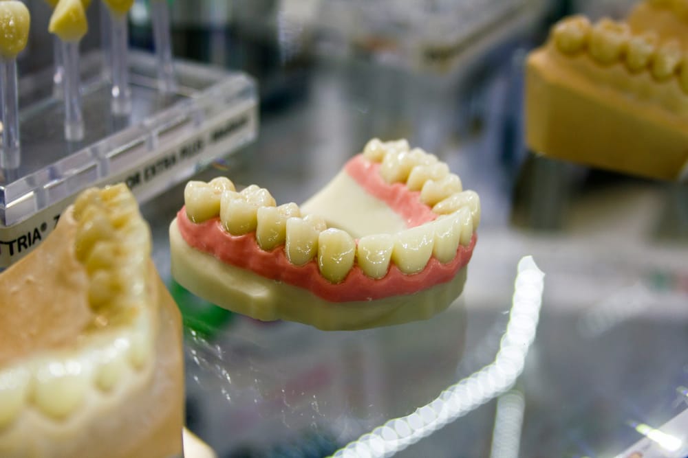 Prótese sobre Implantes Dentários