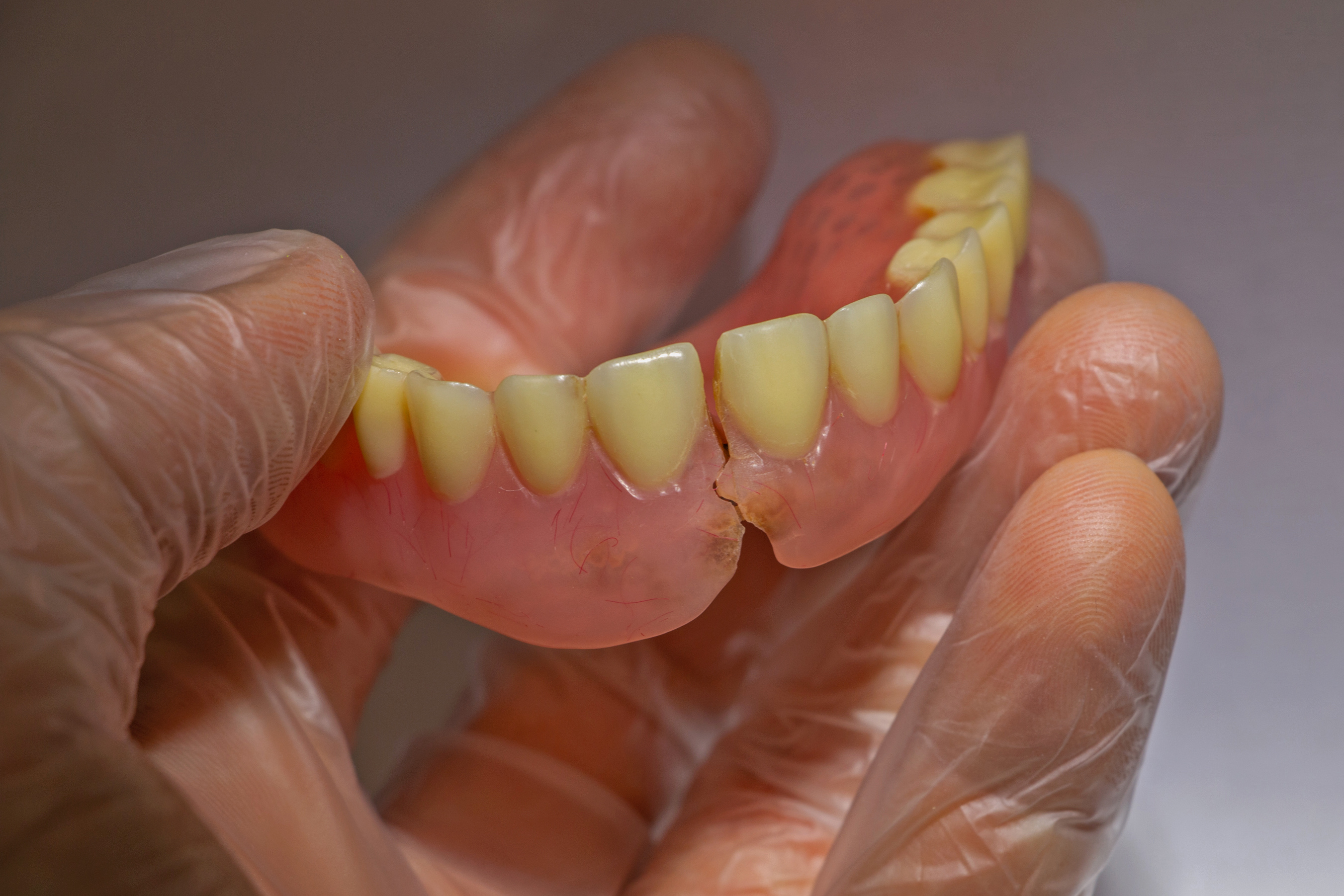 Urgências de Reparação de Prótese Dentária